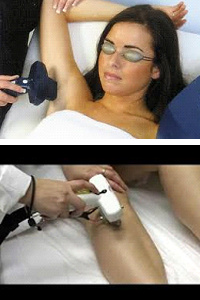 soin chromogenex Lyon Villeurbanne