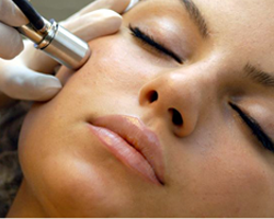 soin dermopeeling Villeurbanne